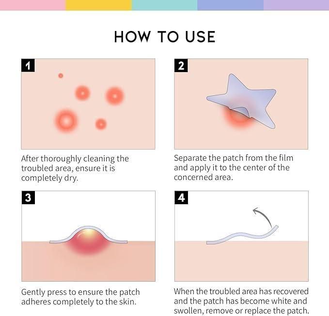 30 Pcs Pimple Patches